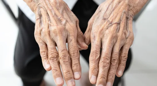 If you see someone with bulging veins, you must tell them these things