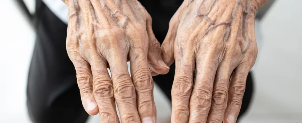 If you see someone with bulging veins, you must tell them these things