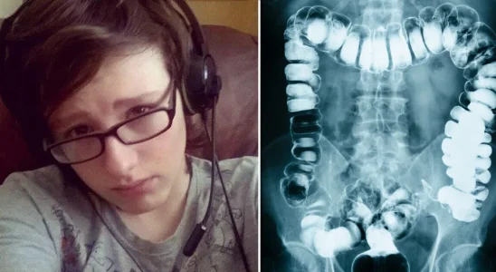 Doctors diagnose teen with 'bad constipation' – 24 hours later he's found dead