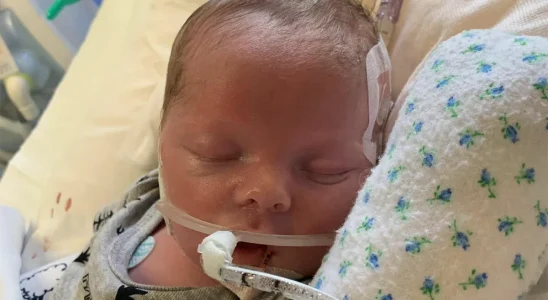Parents say goodbye to their newborn as life support is switched off, then he starts breathing immediately