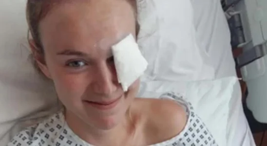 Woman, 30, was diagnosed with deadly brain tumor after thinking sinister symptom was due to long-haul flight